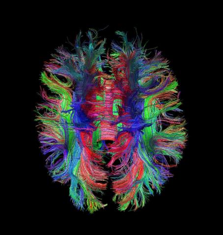 Brain Links